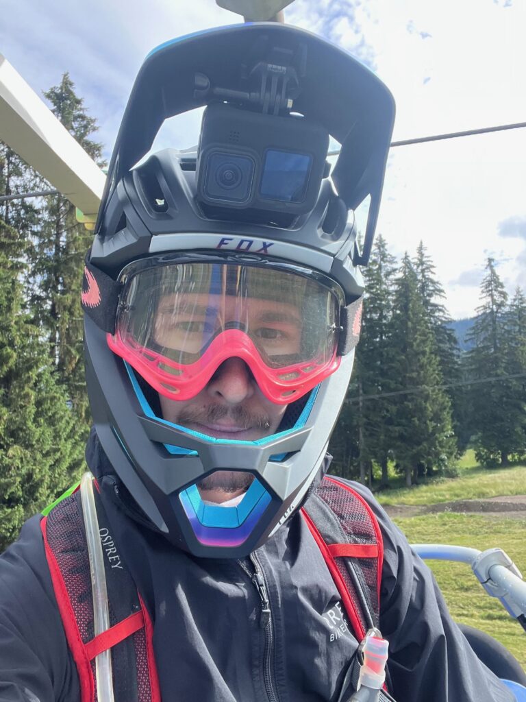 Le Casque Intégral Fox Pro Frame RS : Un Compagnon Idéal pour les Aventures en vtt
